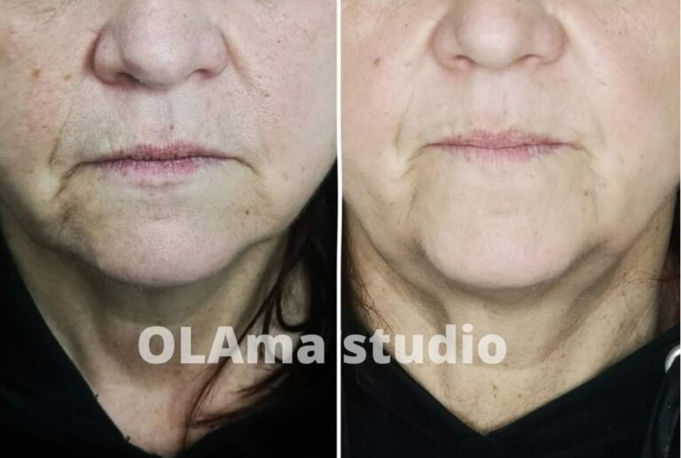 stymulatory tkankowe