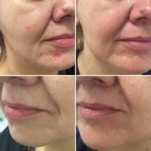 348357207_204566002466874_2663512117883898266_n