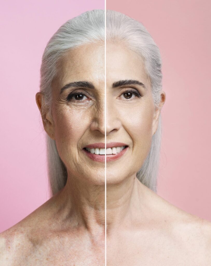 kobieta antyaging fotoodmładzanie