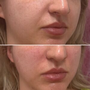 61D5F6CF-AC2C-4C34-B564-96D38672F5DD