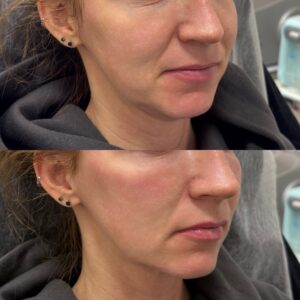 94BC4398-BA3C-4514-8972-6D5B72E4C81E