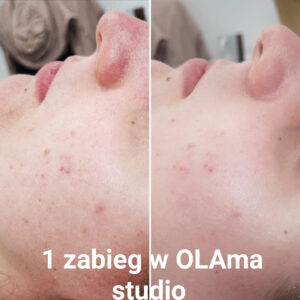 472014442_1155881199203894_5968138376795532312_n